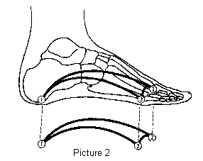 Acquired Flat Feet